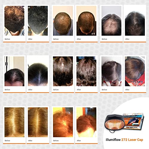 saç Büyümesi için ıllumiflow 272 lazerli başlık - FDA Temizlendi Erkekler ve Kadınlar için Düşük Seviyeli Lazer Tedavisi